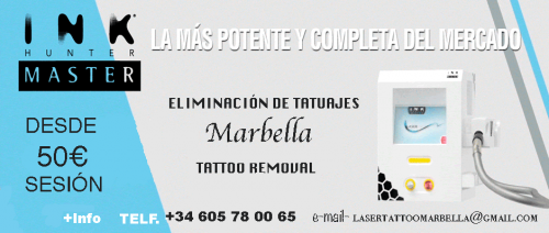 Eliminaci�n de tatuajes Marbella